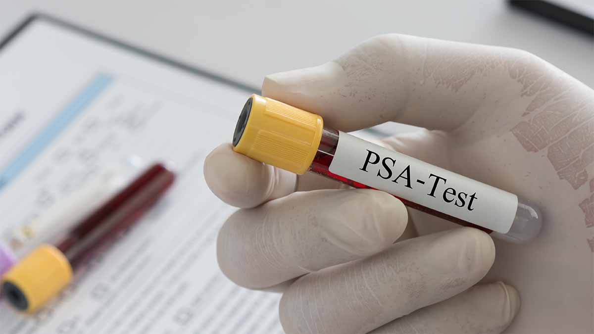 Les médecins généralistes constituent souvent une barrière empêchant les hommes noirs de se faire tester pour le cancer de la prostate