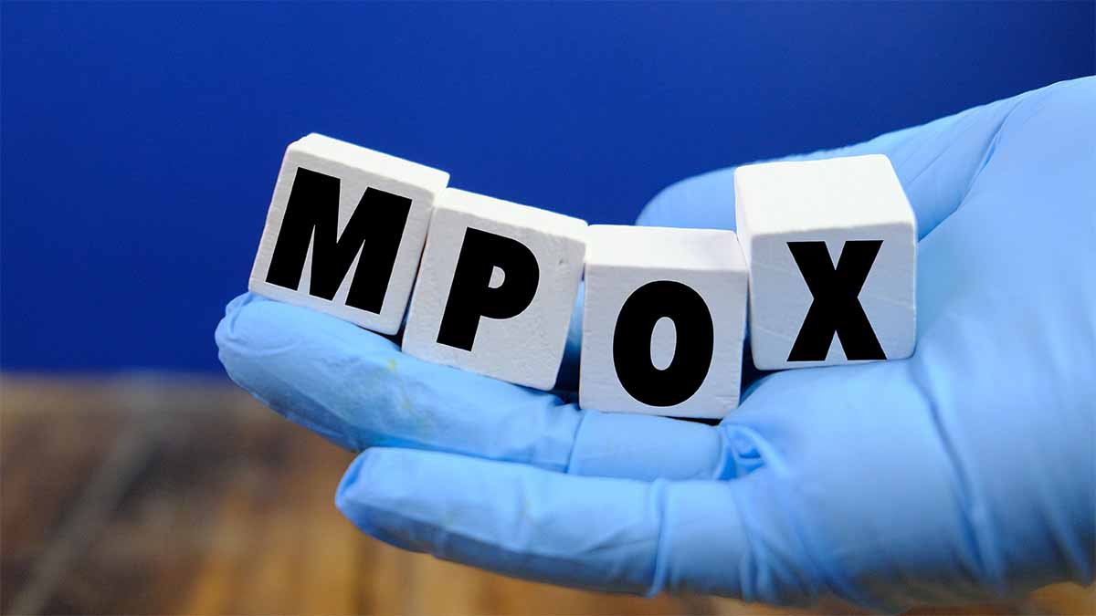 Mpox nécessitera vigilance, éducation et sensibilisation de la part des employeurs