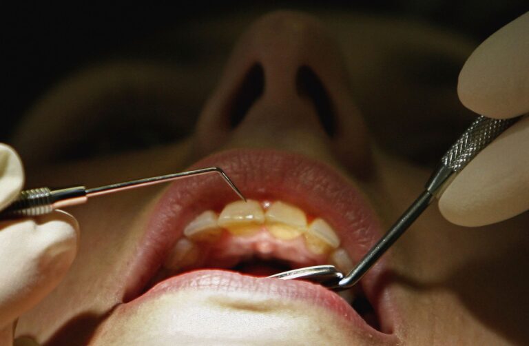 Lancement d’une revue de la dentisterie privée – comment réduire les coûts